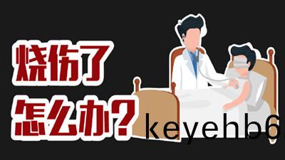 燒(shao)傷了(le)怎麼辦？--四川(chuan)國晉消(xiao)防